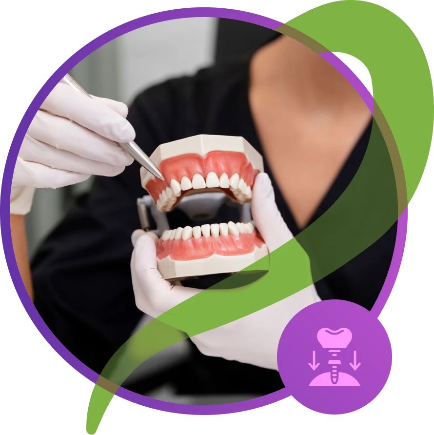 dentures implant