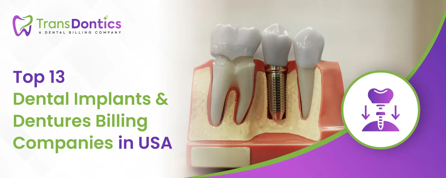 Dental Implants and Dentures Billing Companies in USA